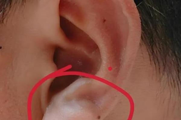 探秘：女人没有耳垂的命理解析与生活影响