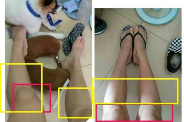 大腿胖的人命里藏着的秘密，你知道吗？