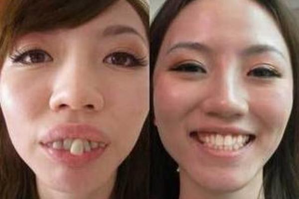 尖牙利嘴命格解析：如何看待这一命运特征的独特魅力