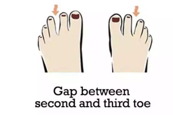 大脚趾太长，命运与性格的奇妙关联探讨