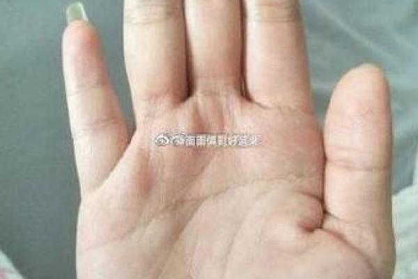 双手断掌男子命运解读：迷雾中寻找自我之路