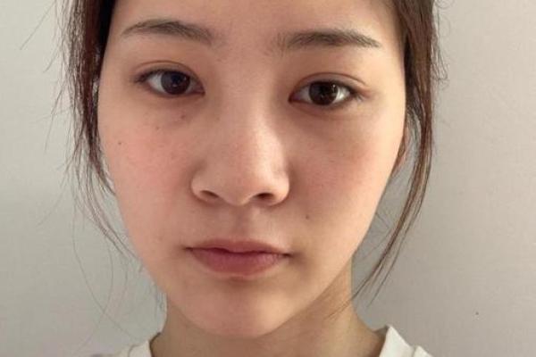 露鼻孔的人是什么命，揭示面相中的秘密与命运解析