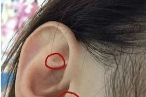 耳垂的秘密：揭示富贵命的隐藏特征与生活智慧