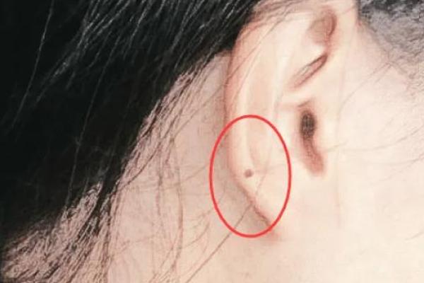 耳朵上有小孔，命运的秘密与生活的启示