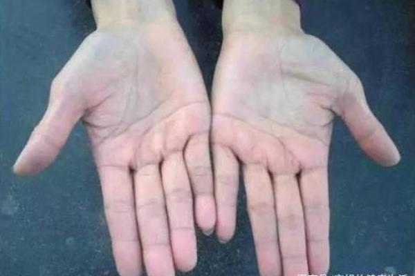 脚背青筋明显,暗示这五种命运特征,你是否中招? 脚背青筋明显,暗示这五种命运特征,你是否中招?