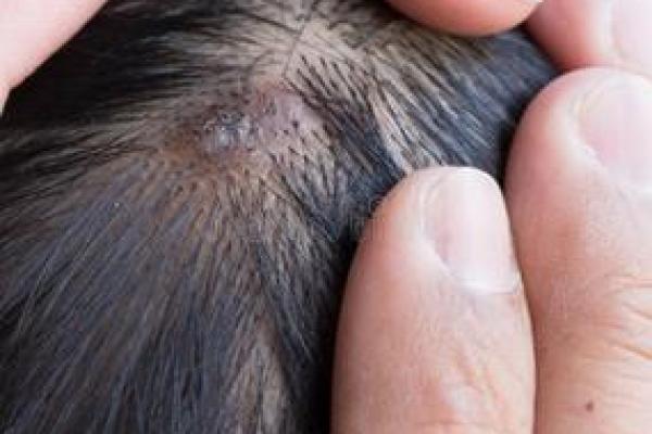 揭开头发里长猴子的谜团:这是什么命? 揭开头发里长猴子的谜团:这是什么命?