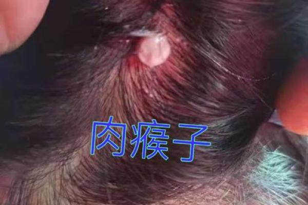 揭开头发里长猴子的谜团:这是什么命? 揭开头发里长猴子的谜团:这是什么命?