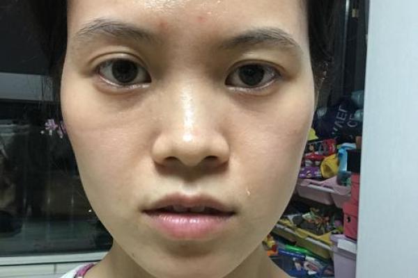 女生鼻子歪是什么命？深度解析与命理探讨！