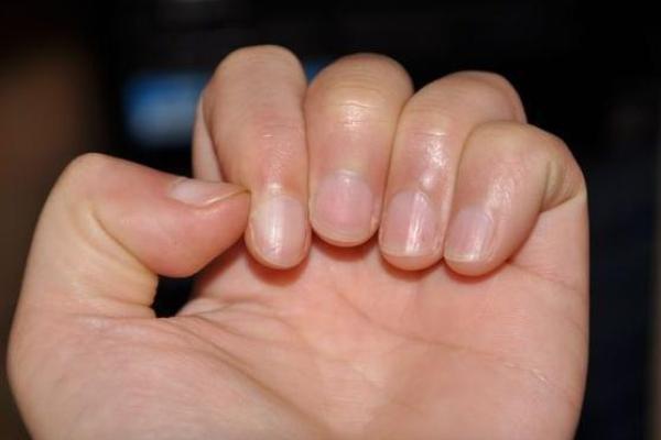 探索黄色指甲背后的命理与健康之谜