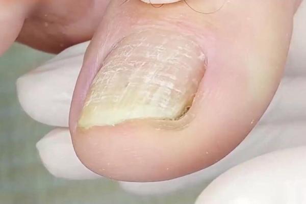 探索黄色指甲背后的命理与健康之谜