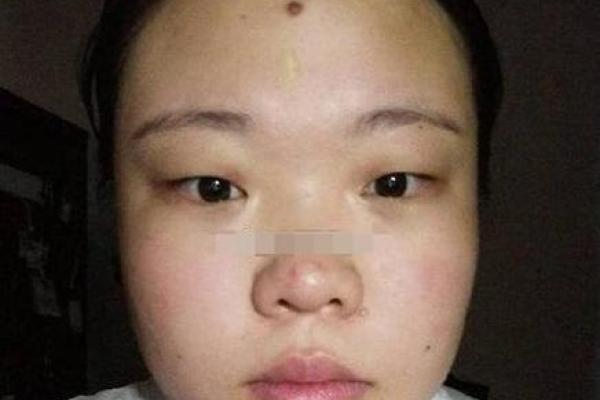 命理学视角：鼻子变大是否暗示着富贵与运势？