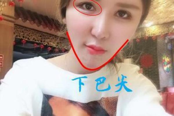 脖子带疤的人命运解析:揭开命运背后的神秘面纱 脖子带疤的人命运解析:揭开命运背后的神秘面纱