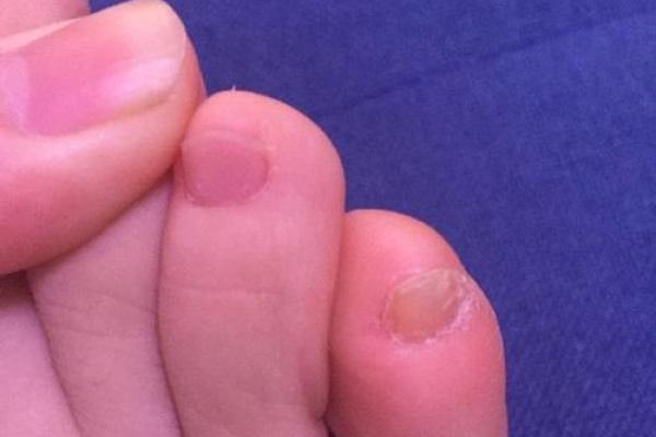 脚趾形状的奥秘:解密你的性格与命运关系! 脚趾形状的奥秘:解密你的性格与命运关系!