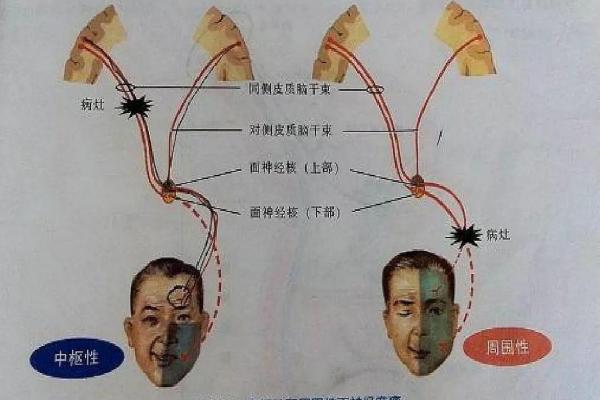 嘴巴有点歪：探索这一特征带来的命运与性格奥秘