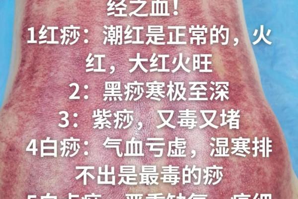 揭秘：后背白斑是何命，背后隐藏的真相！