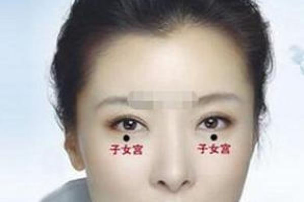 多眼皮的人命运解析:是福是祸? 多眼皮的人命运解析:是福是祸?