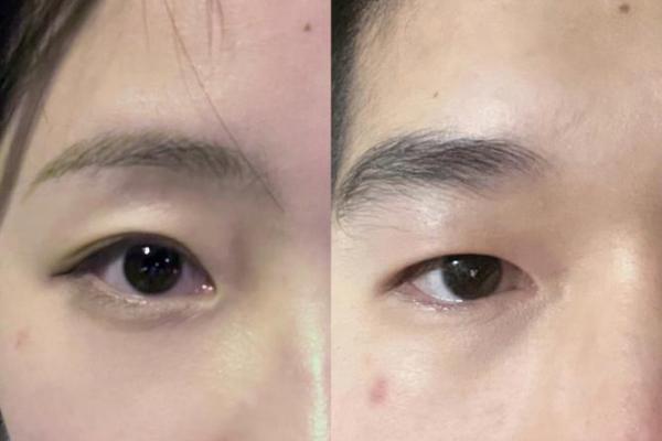 脸上的胎记与命运：揭秘命中注定的五颜六色