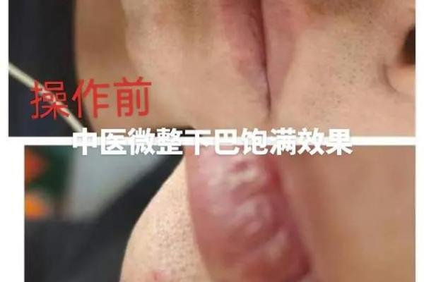 脸蛋上有坑的命运解析：你值得了解的面相秘密
