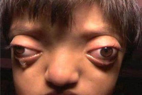 面部畸形与命运：生活中的挑战与希望