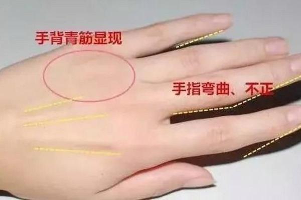 男性左手背纹路的秘密与命运解析