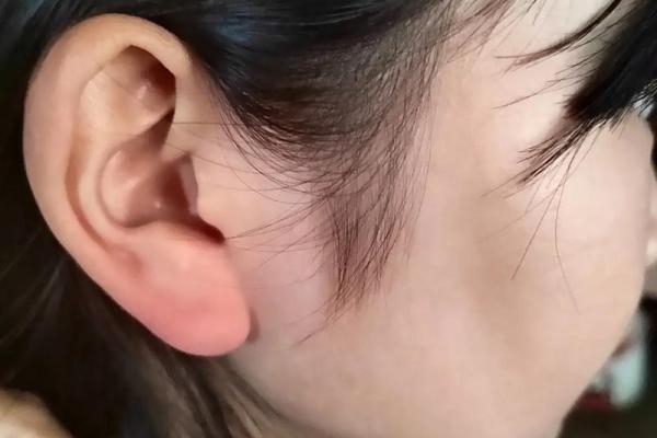 耳廓尖的女人——揭秘她们的命运与个性特征