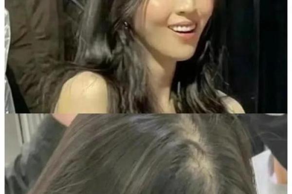 女孩发际线的秘密：她的命运与美丽息息相关
