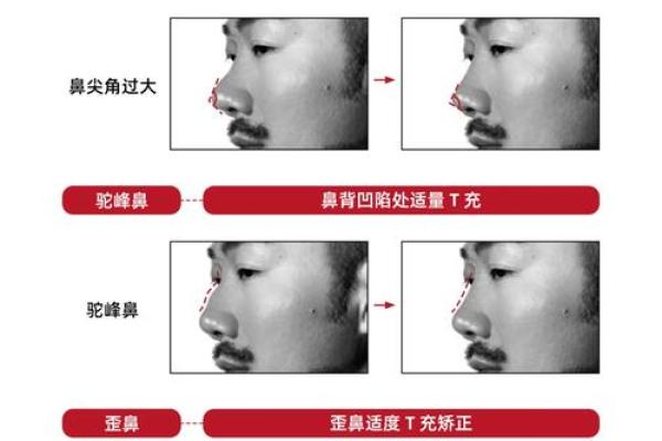 掌握立体鼻型的女生命运：五大特征与成功法则