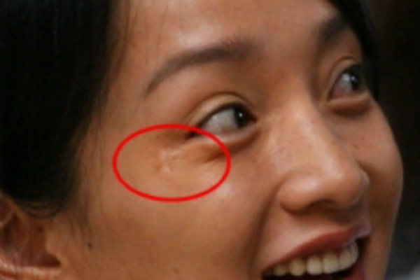 大腿有疤痕的命运分析：暗藏的故事与启示