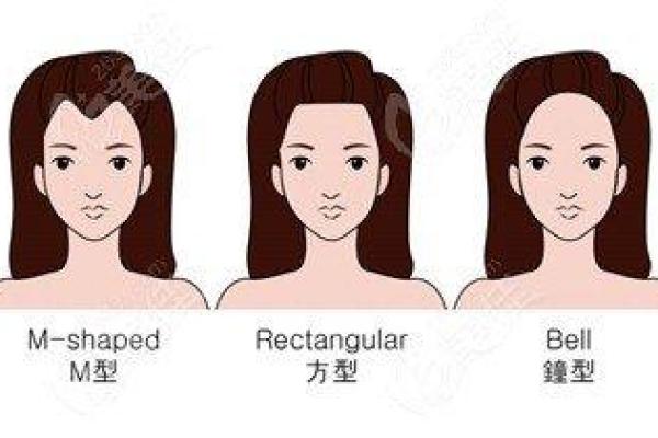 从发际线的形状看命运，探索不同发际线的深层含义