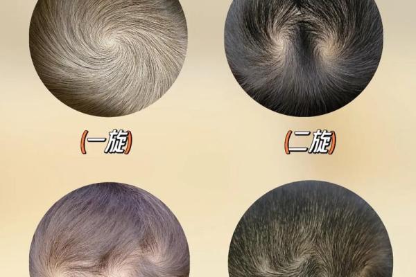 额头特别窄的人命运玄机：探讨命理与性格之间的关系