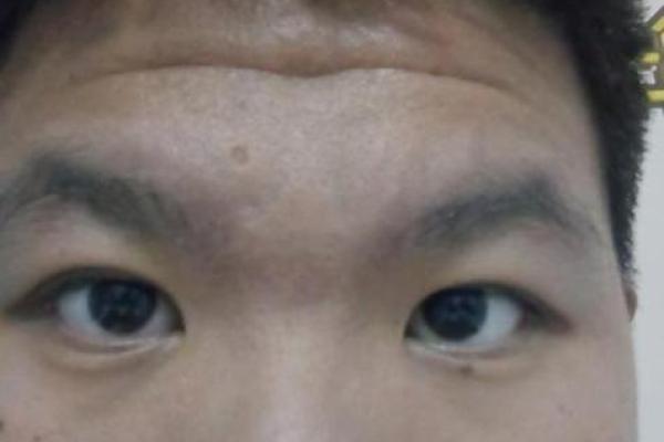 没有鼻梁男生的命运揭秘：从外貌到内心的故事