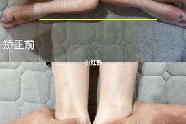 脚趾形状与长短对命运的影响：躲避负能量的秘诀