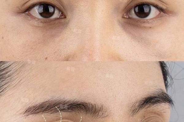 眼骨中间凹陷的命运解析，让你更加了解自身特征！
