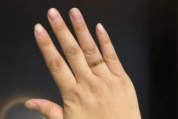 女生手皱巴巴，解密手部皱纹背后的秘密与护理之道