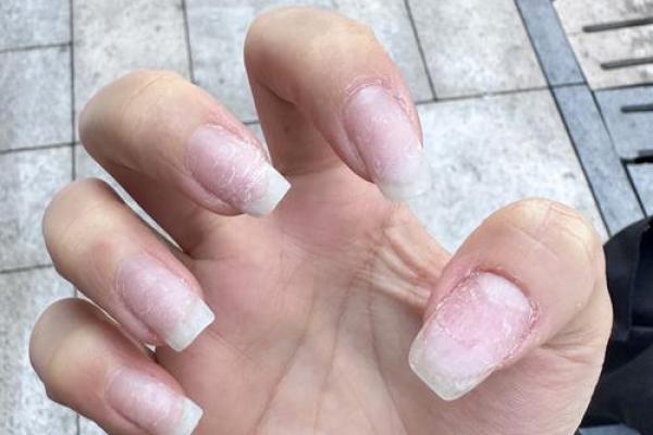 男人指甲丑陋背后隐藏的命运秘密与生活态度