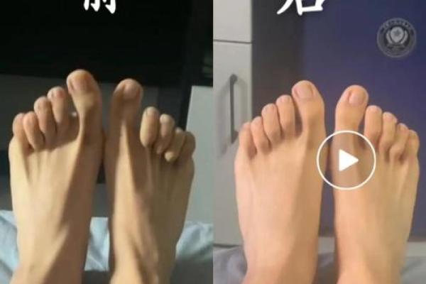 男人脚趾长度的奥秘：你的命运藏于足下！