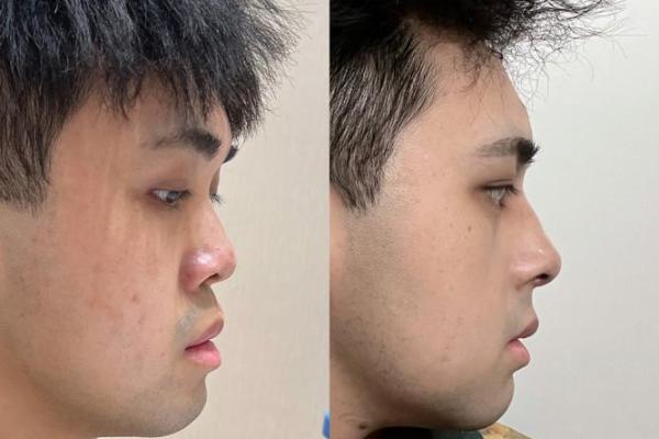 男人鼻子短的命运解析：从面相看性格与运势