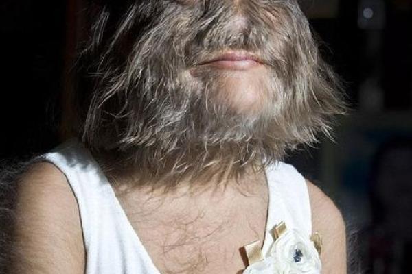 肚脐里面长毛的秘密：揭示身体与命运的神奇关联