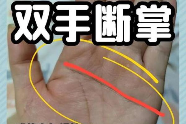 探秘断掌女人的命运：她们拥有怎样的人生轨迹？