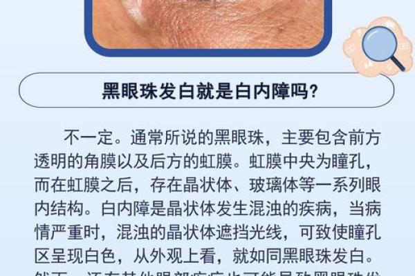 眼睛出现黑点的奥秘与健康警示