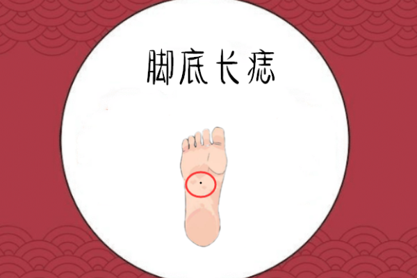 脚底有痣的人命运解析：你的人生暗示与性格特征！