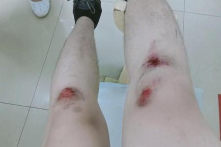 腿上没几根腿毛，究竟是什么命？从容与自信的新解读！