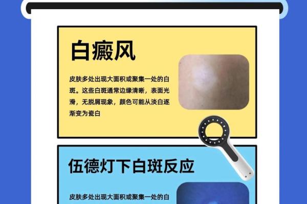 命理解析：白癜风的形成与肤色的秘密
