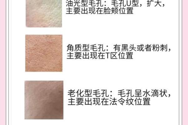 毛孔粗大的命运揭秘:从肌肤问题看性格与命格的关联 毛孔粗大的命运揭秘:从肌肤问题看性格与命格的关联