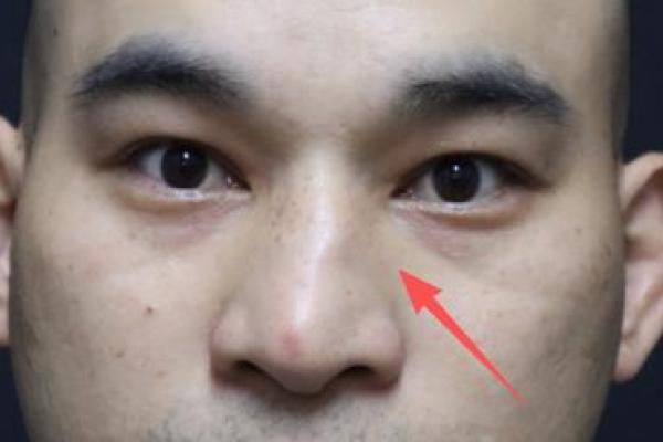 揭秘鼻孔大的命格：他的人生究竟为何如此不同？