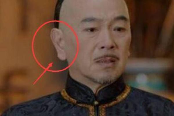 背部肉厚的人命运如何？深度解析与命理的关系